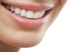 Woman smiling with healthy teeth