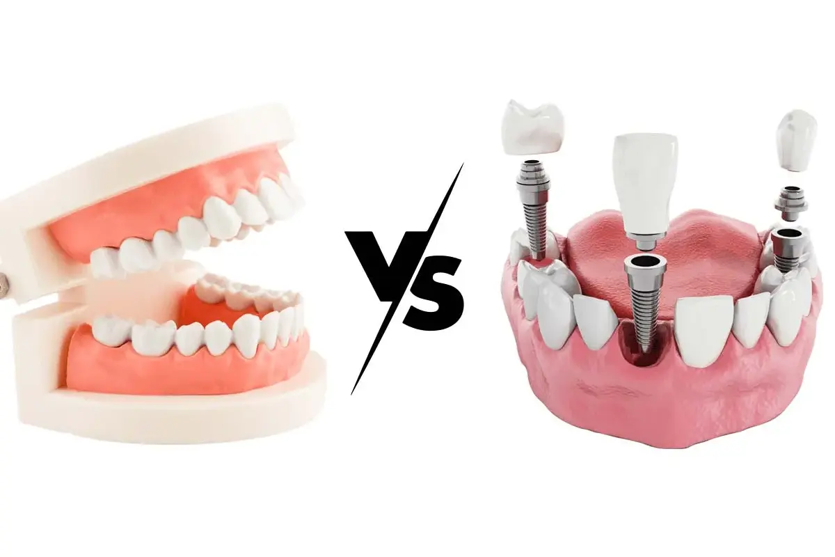 Dentist Vs. Denturist: Who's Best for Your Dental Care?